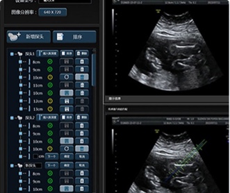 武漢睿影醫(yī)療科技超聲系統(tǒng)軟件UI設(shè)計(jì)